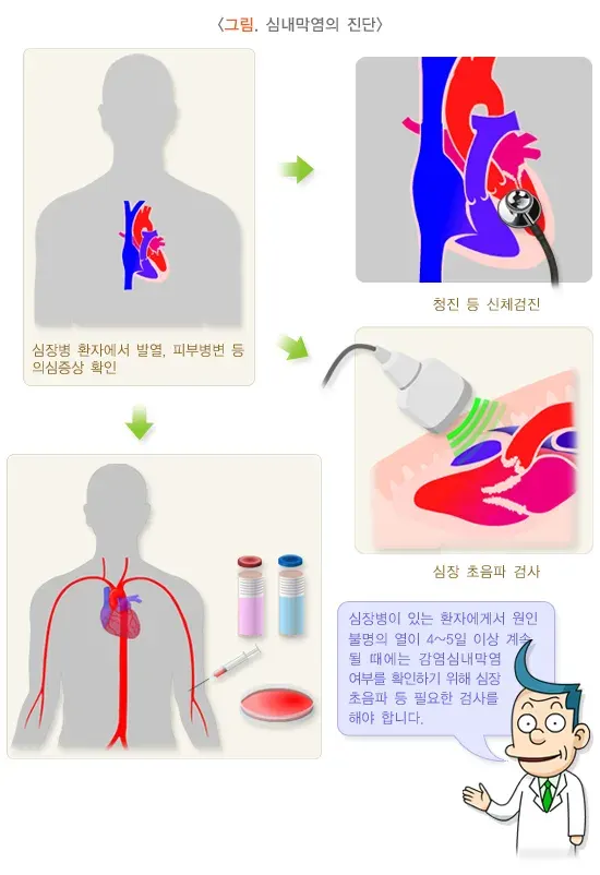감염심내막염 진단 및 검사 설명 이미지 2
