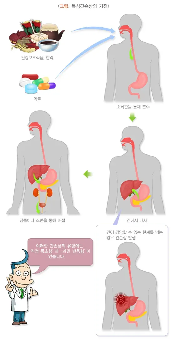 독성 간 손상 정의 설명 이미지 1