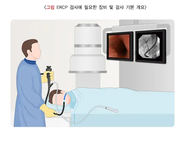 내시경적 역행성 담췌관조영술 검사 장비 설명 이미지 1