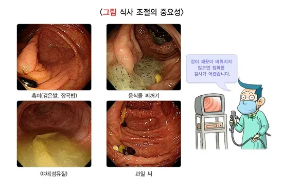 대장내시경검사 검사 준비 설명 이미지 3