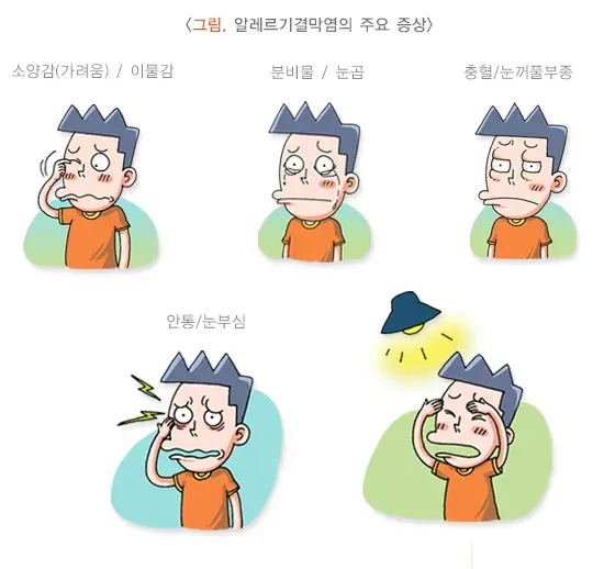 알레르기결막염 증상 설명 이미지 1
