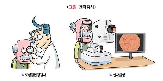 황반변성 진단 및 검사 설명 이미지 1
