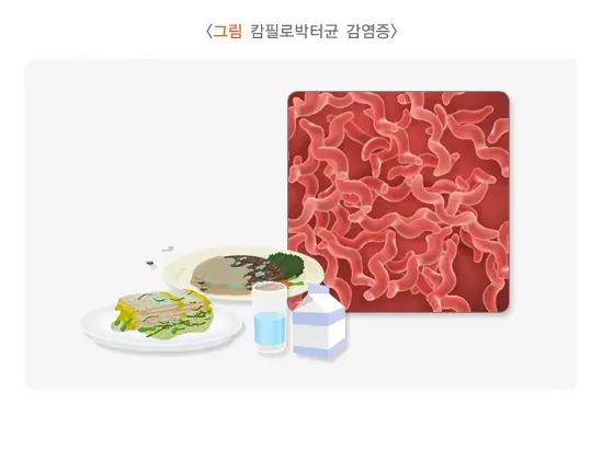 급성 세균성 장염 증상 설명 이미지 8