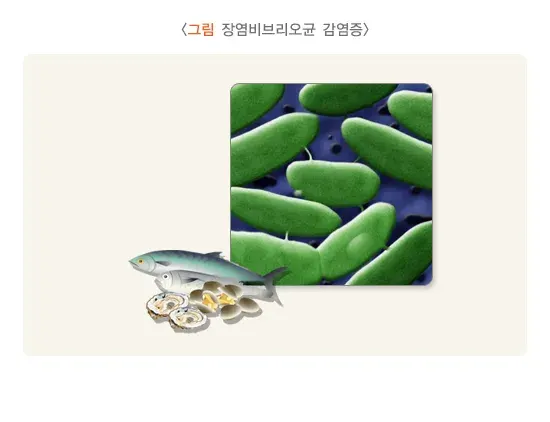 급성 세균성 장염 증상 설명 이미지 4