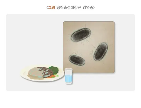 급성 세균성 장염 증상 설명 이미지 6
