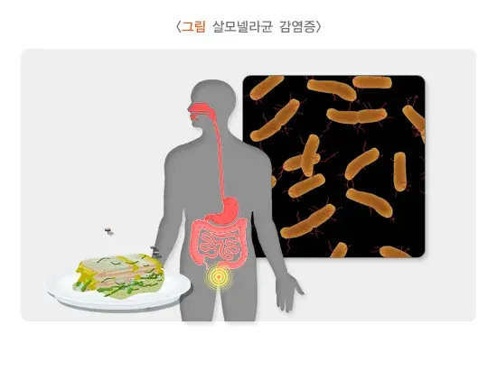 급성 세균성 장염 증상 설명 이미지 3