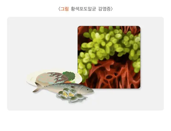 급성 세균성 장염 증상 설명 이미지 10