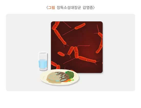 급성 세균성 장염 증상 설명 이미지 5
