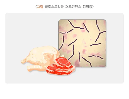급성 세균성 장염 증상 설명 이미지 9