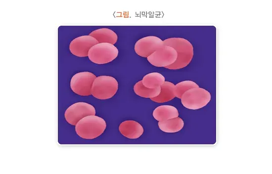 뇌수막염 원인 및 감염경로 설명 이미지 2