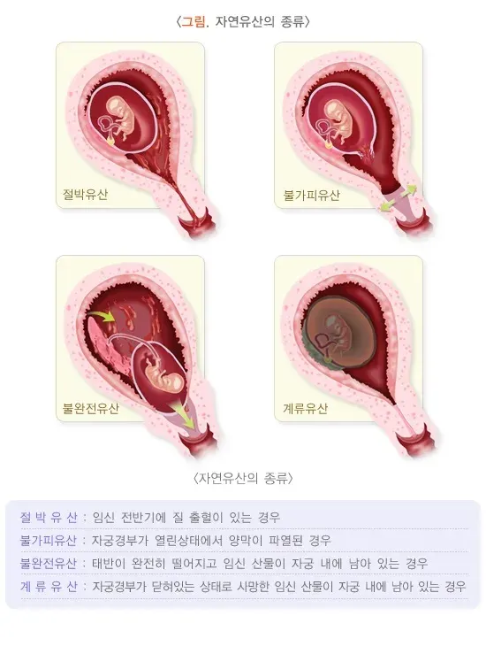 자연유산 종류 설명 이미지 1