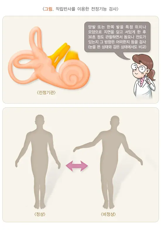 노인 어지럼증 진단 및 검사 설명 이미지 1