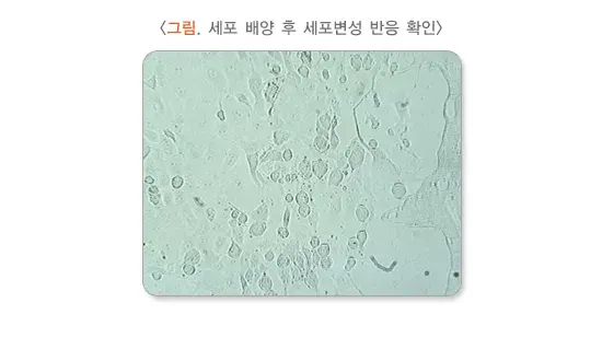 수족구병 진단 및 검사 설명 이미지 1