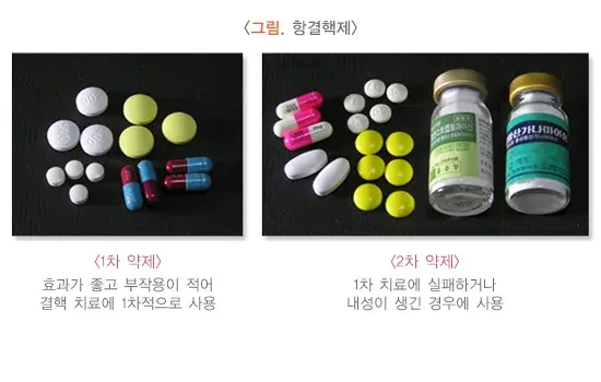장결핵 약물 치료 설명 이미지 1