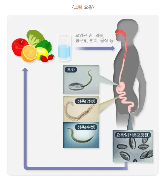 요충증 원인 및 감염경로 설명 이미지 1