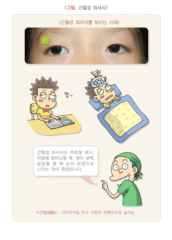 사시 종류 설명 이미지 1