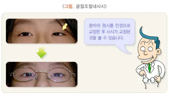 사시 종류 설명 이미지 4