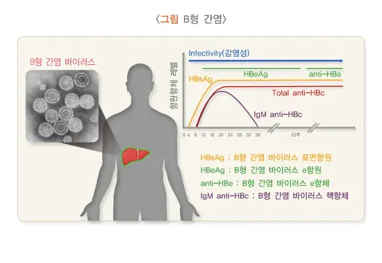 B형간염 증상 설명 이미지 1
