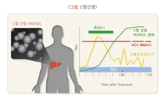 C형간염 증상 설명 이미지 1