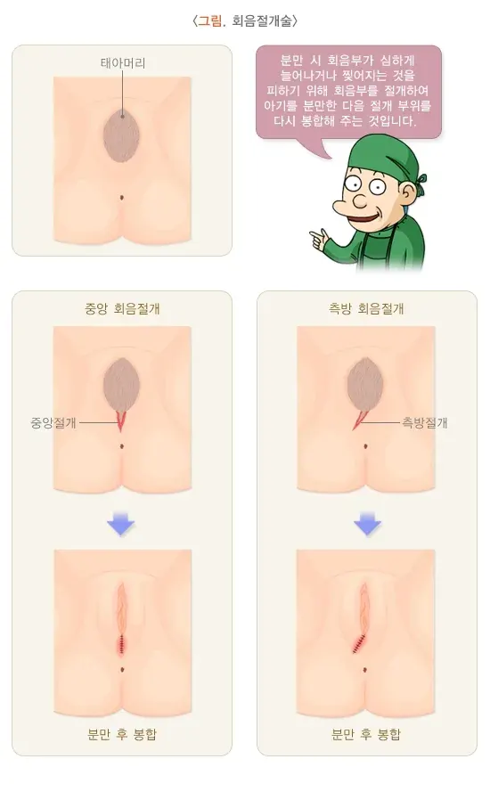 자연분만과정 치료 설명 이미지 3