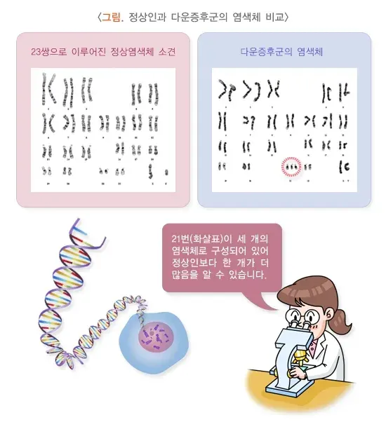 산전 기형아 검사 검사 목적 설명 이미지 1