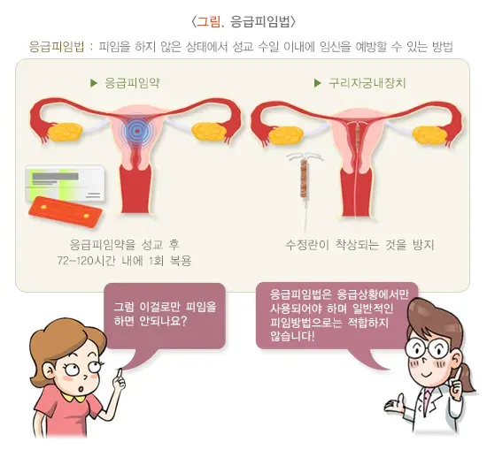 피임 치료 설명 이미지 7