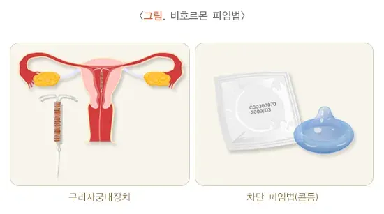 피임 치료 설명 이미지 3