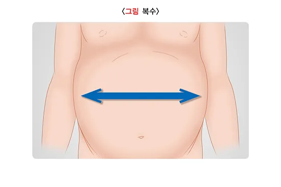 간경변증 증상 설명 이미지 3