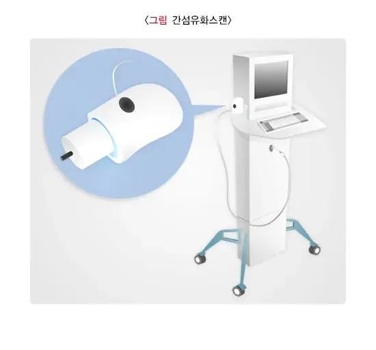 간경변증 진단 및 검사 설명 이미지 2