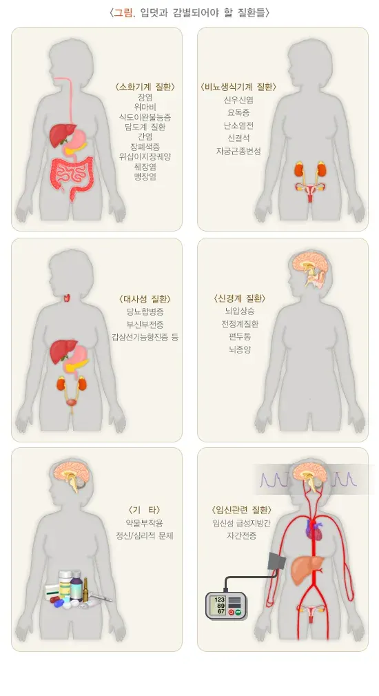 입덧 관련 질환 설명 이미지 1