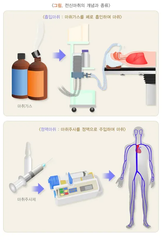 전신마취 치료의 적응증 설명 이미지 3