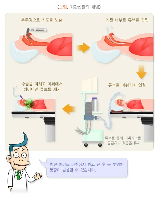 전신마취 치료 방법 설명 이미지 1