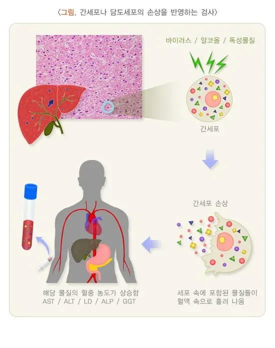 간기능검사 검사 결과 해석 설명 이미지 1