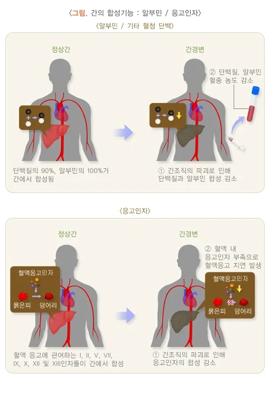 간기능검사 검사 결과 해석 설명 이미지 2