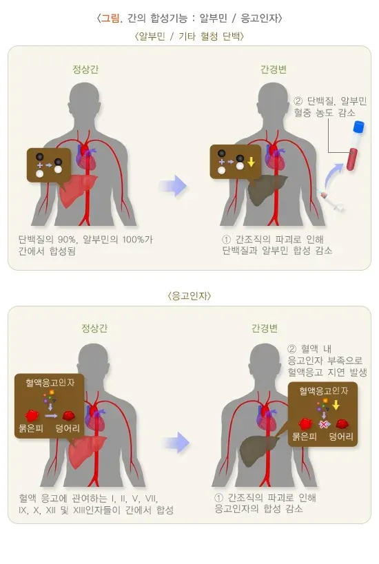 간기능검사 검사 결과 해석 설명 이미지 2