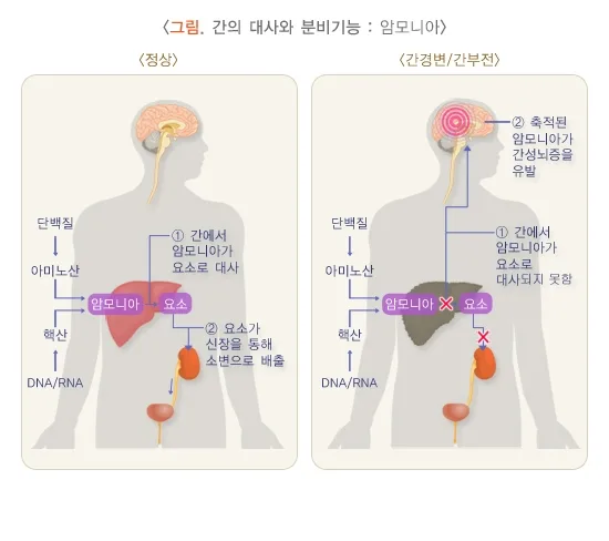 간기능검사 검사 결과 해석 설명 이미지 3