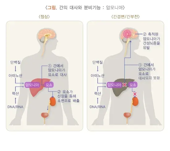 간기능검사 검사 결과 해석 설명 이미지 3