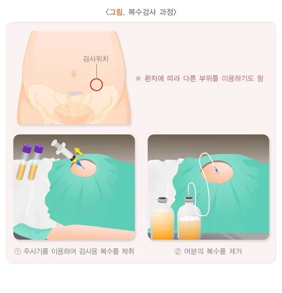 복수검사 검사 절차 설명 이미지 1