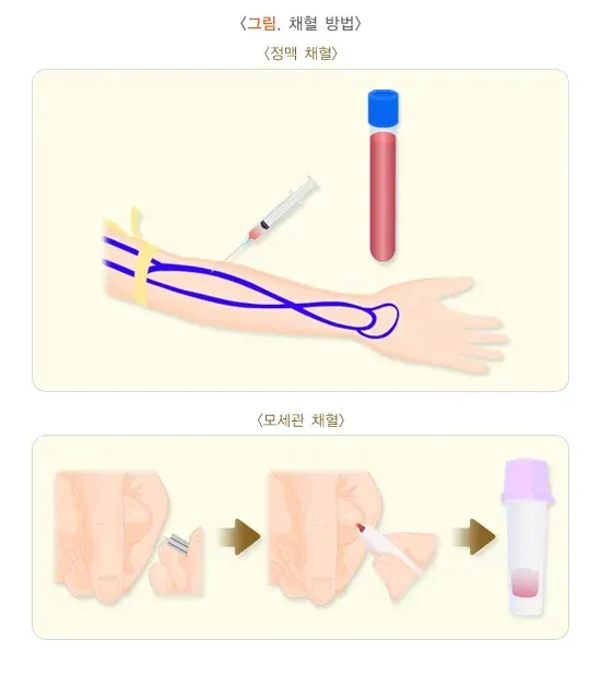 총혈구검사 검사 절차 설명 이미지 1