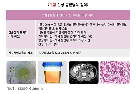 만성콩팥병 정의 설명 이미지 2