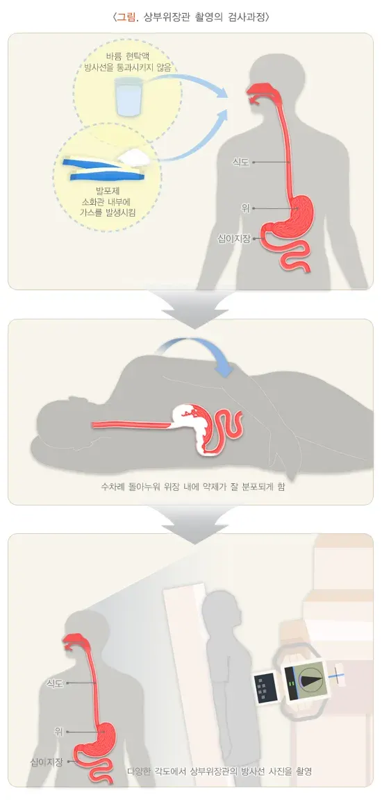 상부위장관 촬영 검사 절차 설명 이미지 1