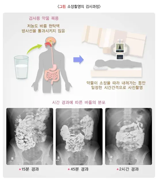 소장 촬영 검사 절차 설명 이미지 1