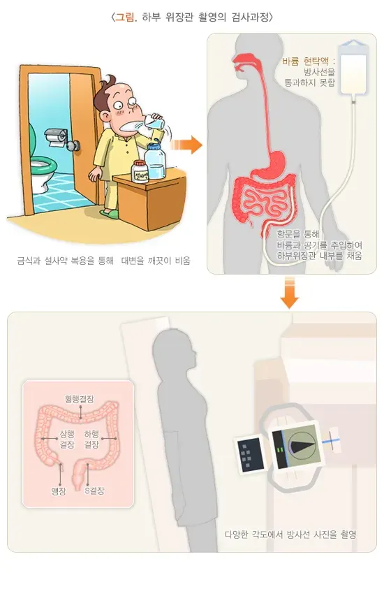 하부위장관 촬영 검사 절차 설명 이미지 1
