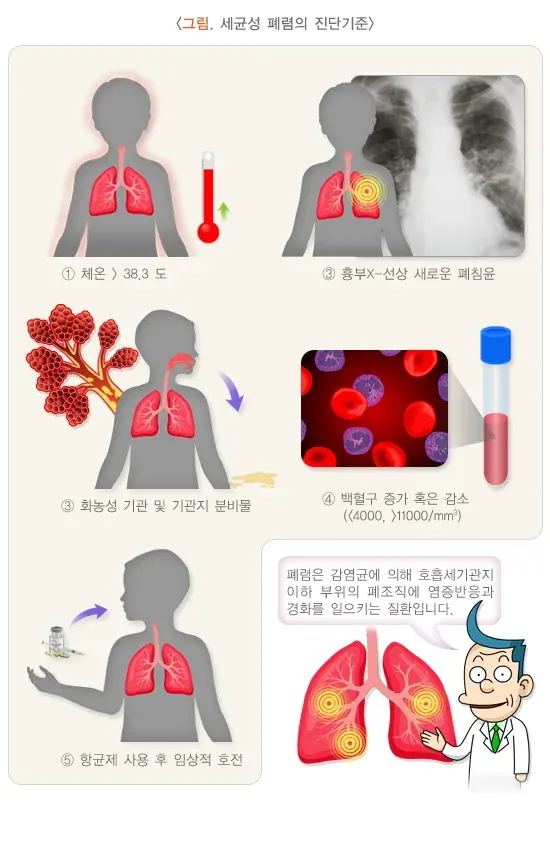 폐렴 진단 및 검사 설명 이미지 1