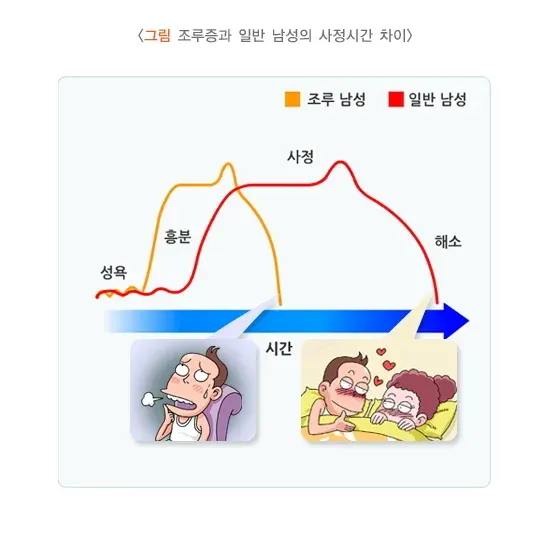 조루증 역학 및 통계 설명 이미지 1