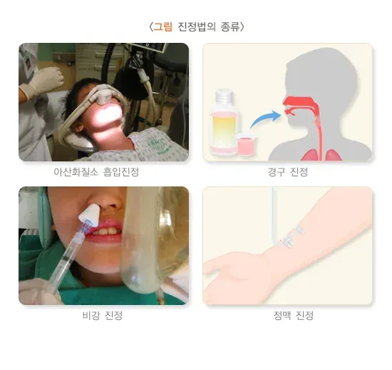 치과진정법 치료 방법 설명 이미지 1
