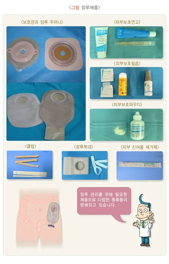 장루 및 장루 관리 도구 관리 설명 이미지 1