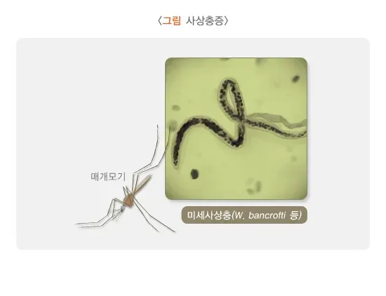 사상충증 원인 및 감염경로 설명 이미지 1