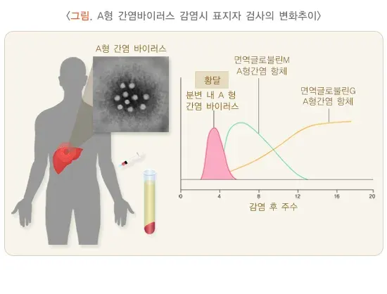 감염질환의 혈청검사 검사 결과 해석 설명 이미지 1