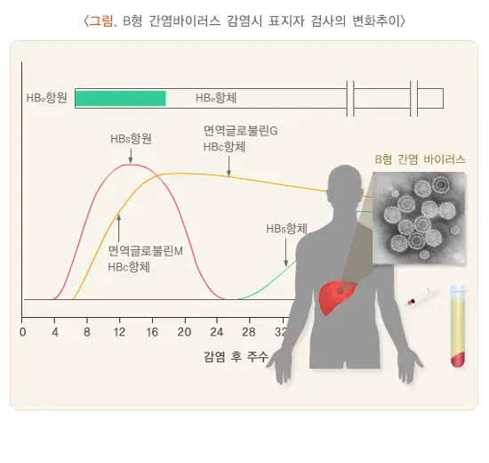 감염질환의 혈청검사 검사 결과 해석 설명 이미지 2